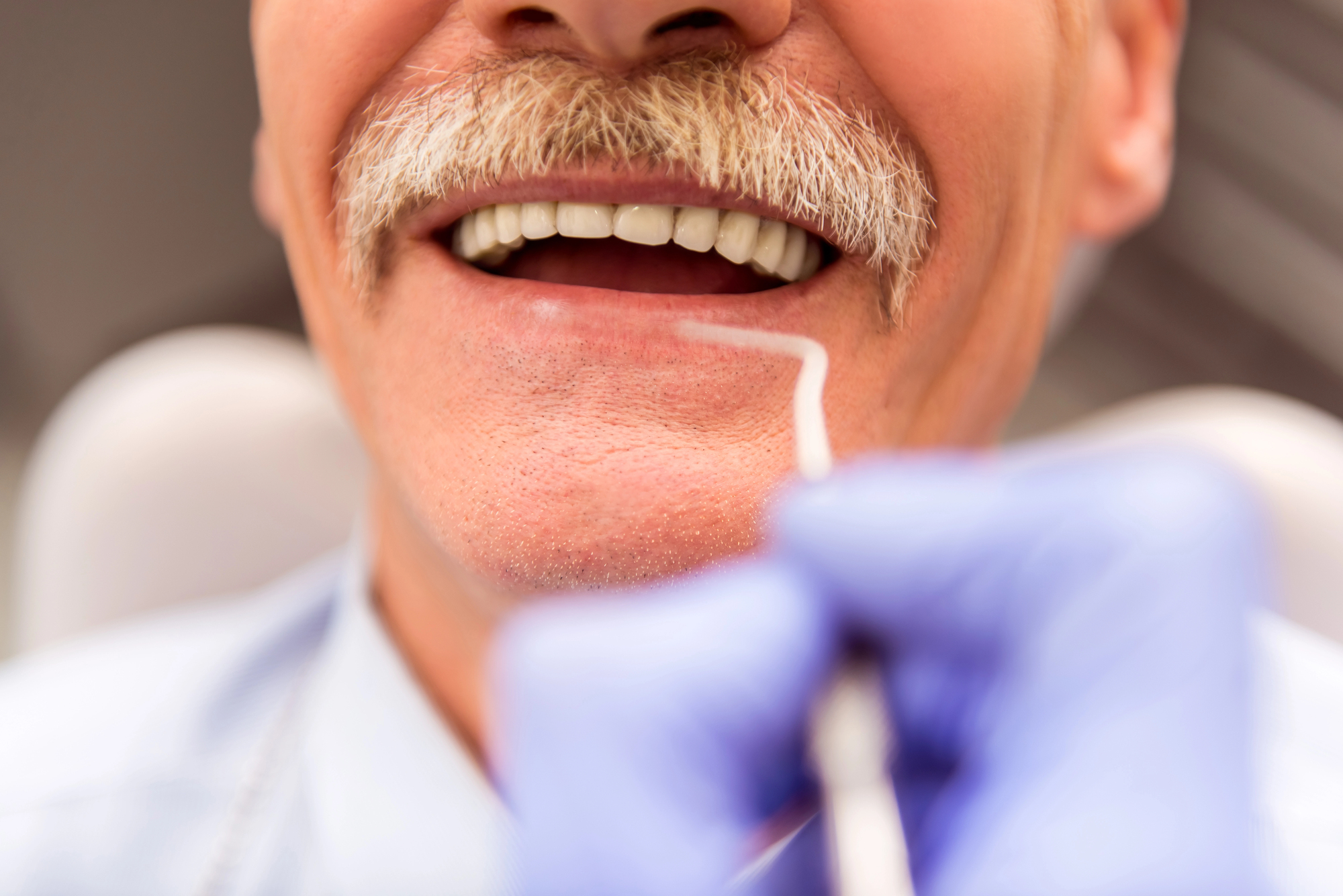 Happy patient at Southern Cal Smiles
