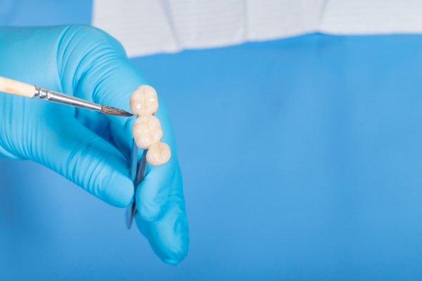 Dental Bridges: A Lasting Solution For Missing Teeth