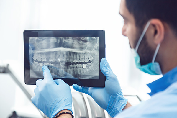 General Dentistry: Are Dental X-rays Recommended? from Southern Cal Smiles: Susan Fredericks, D.D.S, M.P.H. in Woodland Hills, CA