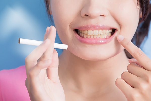 General Dentistry: How Smoking Can Harm Your Teeth