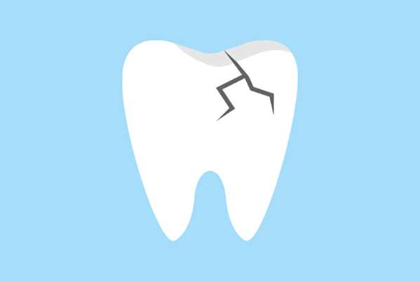 General Dentistry Treatments for a Damaged Tooth from Southern Cal Smiles: Susan Fredericks, D.D.S, M.P.H. in Woodland Hills, CA