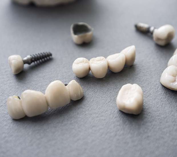 Woodland Hills The Difference Between Dental Implants and Mini Dental Implants
